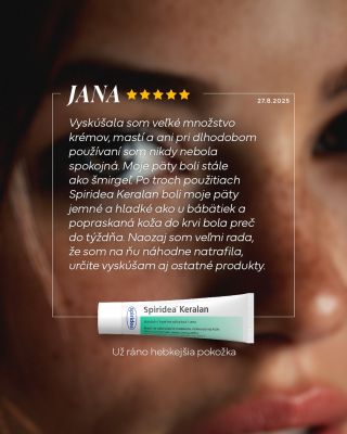 💬 Keď sa ženy delia o svoje príbehy, ich skúsenosti nás dojímajú a tešia. 💚 Dávajú zmysel tomu, čo robíme každý deň. 🌿 Sú...